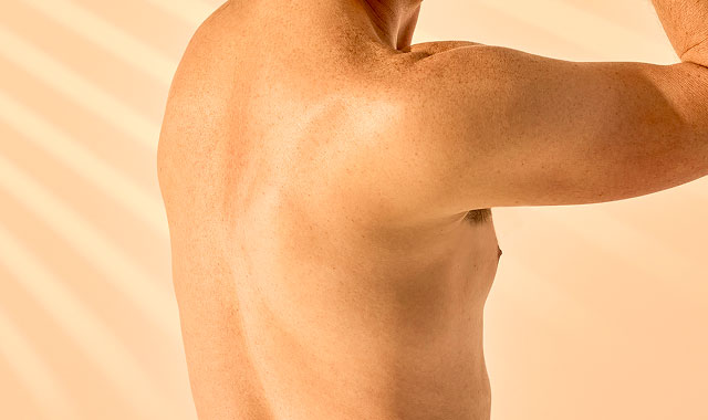 Laser Hair Removal - Half Back